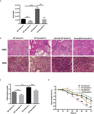 Exogenous Semaphorin 3E treatment protects against chlamydial lung infection in mice